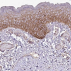 Immunohistochemical staining of human skin shows strong membranous positivity in squamous epithelial cells.