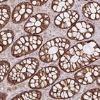 Immunohistochemical staining of human rectum shows strong cytoplasmic positivity in glandular cells.