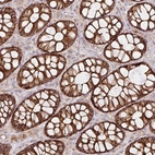 Immunohistochemical staining of human rectum shows strong cytoplasmic positivity in glandular cells.