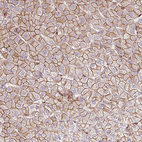 Immunohistochemical staining of human liver shows strong membranous positivity in hepatocytes.