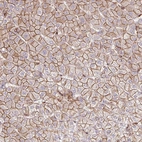 Immunohistochemical staining of human liver shows strong membranous positivity in hepatocytes.