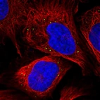 Immunofluorescent staining of human cell line U-2 OS shows localization to vesicles.