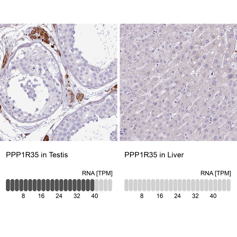 Anti-PPP1R35 Antibody