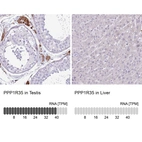 Anti-PPP1R35 Antibody