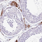 Immunohistochemical staining of human testis shows high expression.