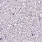 Immunohistochemical staining of human liver shows low expression as expected.
