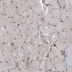 Immunohistochemical staining of human skeletal muscle shows strong nuclear positivity in myocytes.