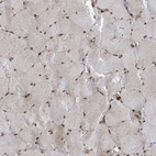 Immunohistochemical staining of human skeletal muscle shows strong nuclear positivity in myocytes.