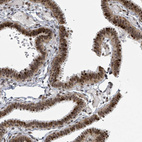 Immunohistochemical staining of human fallopian tube shows strong nuclear positivity in glandular cells.