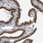 Immunohistochemical staining of human fallopian tube shows strong nuclear positivity in glandular cells.