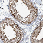 Immunohistochemical staining of human testis shows strong nuclear positivity in cells in seminiferous ducts.