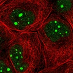 Immunofluorescent staining of human cell line A-431 shows localization to nucleus & nucleoli.