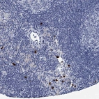 Anti-VPS13D Antibody
