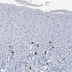 Immunohistochemical staining of human skin shows strong cytoplasmic positivity in mast cell.