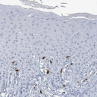 Immunohistochemical staining of human skin shows strong cytoplasmic positivity in mast cell.