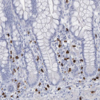 Immunohistochemical staining of human small intestine shows strong cytoplasmic positivity in lymphoid cells.