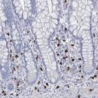 Immunohistochemical staining of human small intestine shows strong cytoplasmic positivity in lymphoid cells.
