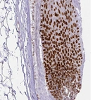 Anti-HOXC13 Antibody