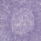Anti-HOXC13 Antibody