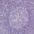 Immunohistochemical staining of human lymph node shows no positivity in germinal center cells as expected.