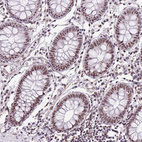 Immunohistochemical staining of human colon shows moderate nuclear positivity in glandular cells.