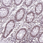 Immunohistochemical staining of human colon shows moderate nuclear positivity in glandular cells.