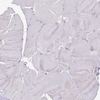 Immunohistochemical staining of human skeletal muscle shows no positivity in myocytes as expected.