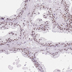 Immunohistochemical staining of human prostate shows moderate nuclear positivity in glandular cells.