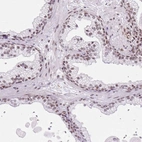 Immunohistochemical staining of human prostate shows moderate nuclear positivity in glandular cells.