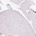 Immunohistochemical staining of human skeletal muscle shows no positivity in myocytes as expected .