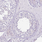 Immunohistochemical staining of human testis shows no positivity in cells in seminiferous ducts as expected.