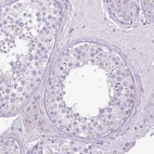 Immunohistochemical staining of human testis shows no positivity in cells in seminiferous ducts as expected.