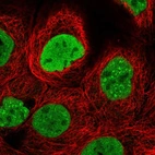Immunofluorescent staining of human cell line A-431 shows localization to nucleoplasm & nuclear speckles.