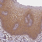 Immunohistochemical staining of human cervix shows moderate cytoplasmic positivity in squamous epithelial cells.