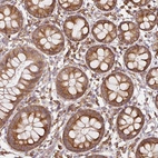 Immunohistochemical staining of human colon shows moderate cytoplasmic positivity in glandular cells.