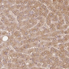 Immunohistochemical staining of human liver shows moderate cytoplasmic positivity in hepatocytes.