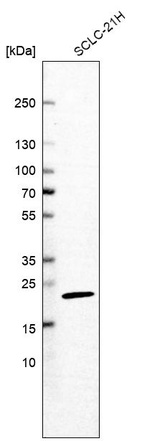 Western blot analysis in human cell line SCLC-21H.