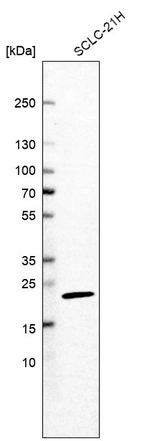 Western blot analysis in human cell line SCLC-21H.