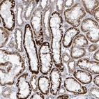 Anti-ALG12 Antibody