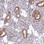 Anti-MRPL21 Antibody