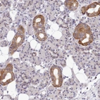 Anti-MRPL21 Antibody