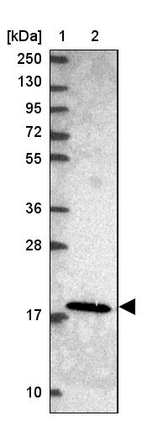 Lane 1: Marker [kDa] 250, 130, 95, 72, 55, 36, 28, 17, 10_br/_Lane 2: Human cell line RT-4