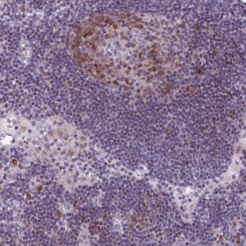 Anti-PQLC1 Antibody