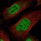 Immunofluorescent staining of human cell line U-2 OS shows localization to nucleoplasm.