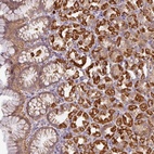 Anti-STK35 Antibody