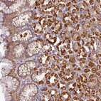 Anti-STK35 Antibody