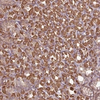 Anti-ACTR3 Antibody