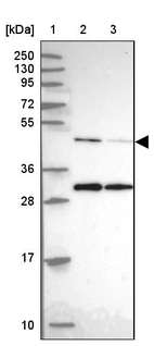Lane 1: Marker [kDa] 250, 130, 95, 72, 55, 36, 28, 17, 10_br/_Lane 2: Human cell line RT-4_br/_Lane 3: Human cell line U-251MG sp