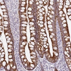 Immunohistochemical staining of human small intestine shows strong granular cytoplasmic positivity in glandular cells.