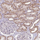 Immunohistochemical staining of human kidney shows moderate cytoplasmic positivity in cells in tubules.